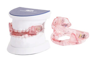 Mandibular Advancement Splints